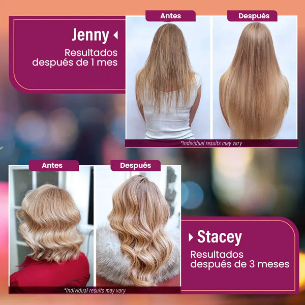 HAIR GROWTH- ENVIO GRATIS🌸